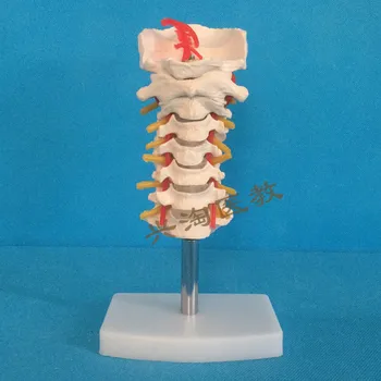 צוואר הרחם שלד דגם עם העורק הראשי האחורי עצם העורף דיסק בין-חולייתי ואת העצבים